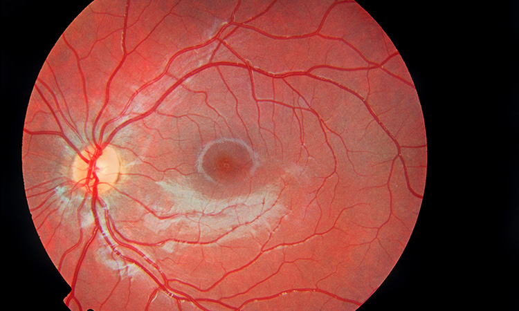 L'oeil, la lumière et la vision - L'oeil et le cerveau - 2mn 43s